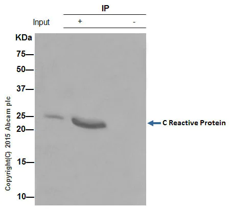 Immunoprecipitation - Anti-C Reactive Protein antibody [Y284] - BSA and Azide free (AB271830)