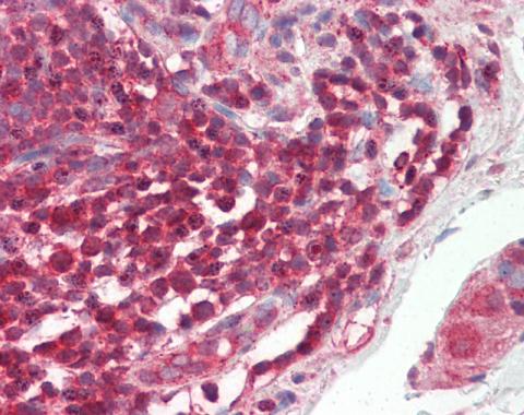 Immunohistochemistry (Formalin/PFA-fixed paraffin-embedded sections) - Anti-c-Rel antibody - N-terminal (AB227519)