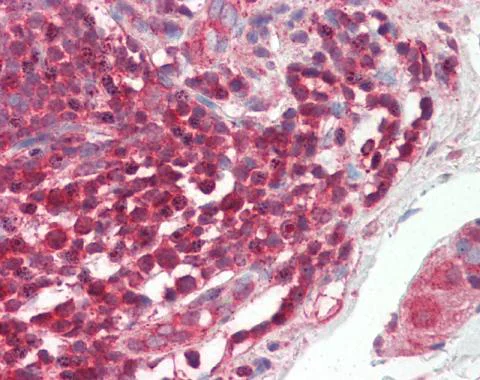 Immunohistochemistry (Formalin/PFA-fixed paraffin-embedded sections) - Anti-c-Rel antibody - N-terminal (AB227519)