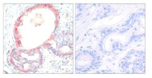 Immunohistochemistry (Formalin/PFA-fixed paraffin-embedded sections) - Anti-c-Rel (phospho S503) antibody (AB30624), expandable thumbnail