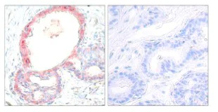 Immunohistochemistry (Formalin/PFA-fixed paraffin-embedded sections) - Anti-c-Rel (phospho S503) antibody (AB30624)