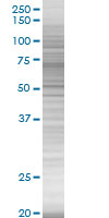 SDS-PAGE - C1 Inactivator overexpression 293T lysate (whole cell) (AB94134), expandable thumbnail