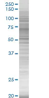 SDS-PAGE - C1 Inactivator overexpression 293T lysate (whole cell) (AB94134)