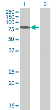 Western blot - C1 Inactivator overexpression 293T lysate (whole cell) (AB94134), expandable thumbnail