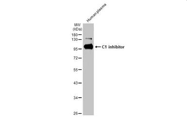 Western blot - Anti-C1 inhibitor antibody [HL1196] - BSA and Azide free (AB313834)