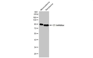 Western blot - Anti-C1 inhibitor antibody [HL1196] - BSA and Azide free (AB313834)