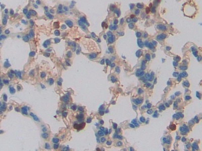 Immunohistochemistry (Formalin/PFA-fixed paraffin-embedded sections) - Anti-C10 antibody (AB231609)