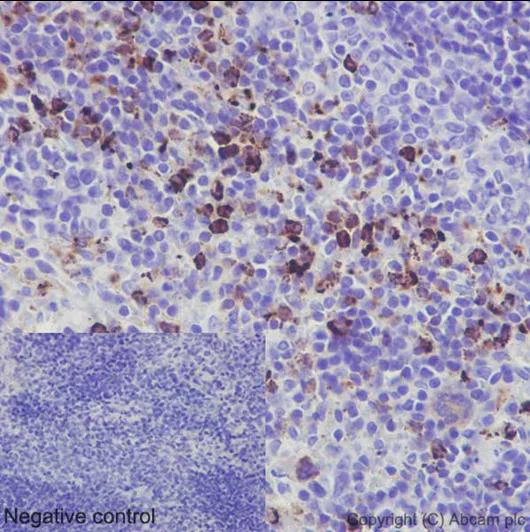 Immunohistochemistry (Formalin/PFA-fixed paraffin-embedded sections) - Anti-C10 antibody [EPR14614] (AB191400)