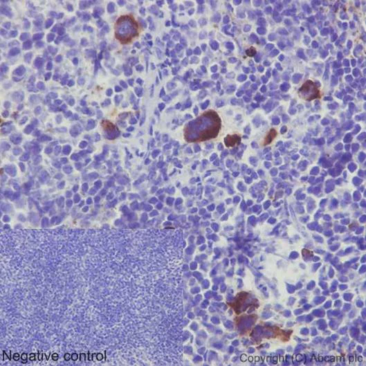 Immunohistochemistry (Formalin/PFA-fixed paraffin-embedded sections) - Anti-C10 antibody [EPR14614] - BSA and Azide free (AB251064)