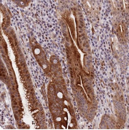 Immunohistochemistry (Formalin/PFA-fixed paraffin-embedded sections) - Anti-C10orf11 antibody (AB150986)