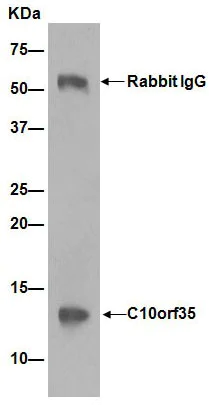 Immunoprecipitation - Anti-C10orf35 antibody [EP14950-82] (AB189923)