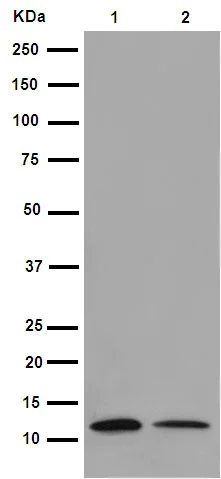 Western blot - Anti-C10orf35 antibody [EP14950-82] - BSA and Azide free (AB284845)