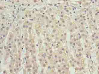 Immunohistochemistry (Formalin/PFA-fixed paraffin-embedded sections) - Anti-C10orf54 antibody (AB235362)