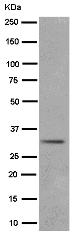 Western blot - Anti-C10orf63 antibody [EPR14013] - BSA and Azide free (AB250885)