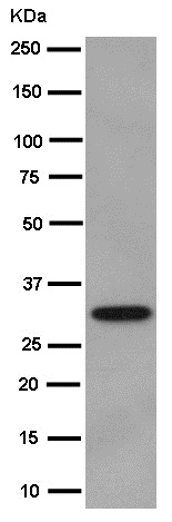 Western blot - Anti-C10orf63 antibody [EPR14013] - BSA and Azide free (AB250885), expandable thumbnail