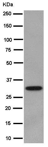 Western blot - Anti-C10orf63 antibody [EPR14013] - BSA and Azide free (AB250885)