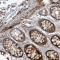 Immunohistochemistry (Formalin/PFA-fixed paraffin-embedded sections) - Anti-C10orf99 antibody (AB151109)