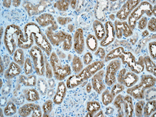 Immunohistochemistry (Formalin/PFA-fixed paraffin-embedded sections) - Anti-C11B2/CYP11B2 antibody [EPR10494] (AB168388)