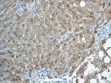 Immunohistochemistry (Formalin/PFA-fixed paraffin-embedded sections) - Anti-C11B2/CYP11B2 antibody [EPR10494] (AB168388)