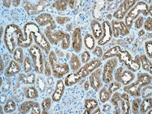 Immunohistochemistry (Formalin/PFA-fixed paraffin-embedded sections) - Anti-C11B2/CYP11B2 antibody [EPR10494] - BSA and Azide free (AB249476)