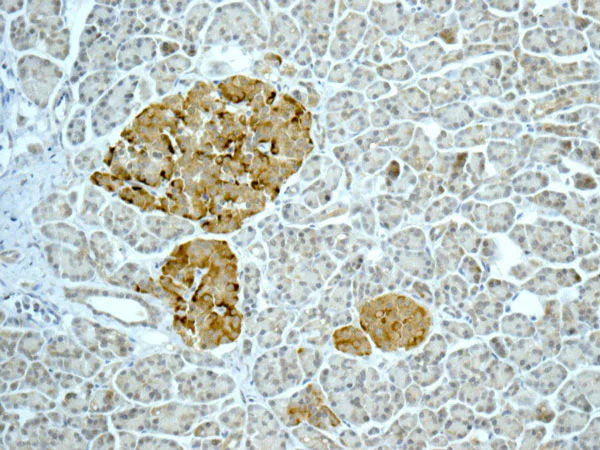 Immunohistochemistry (Formalin/PFA-fixed paraffin-embedded sections) - Anti-C11B2/CYP11B2 antibody [EPR10494] - BSA and Azide free (AB249476)