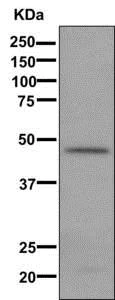 Western blot - Anti-C11B2/CYP11B2 antibody [EPR10494] - BSA and Azide free (AB249476)