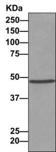Immunoprecipitation - Anti-C11B2/CYP11B2 antibody [EPR10495] (AB167413)