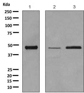 Western blot - Anti-C11B2/CYP11B2 antibody [EPR10495] (AB167413)