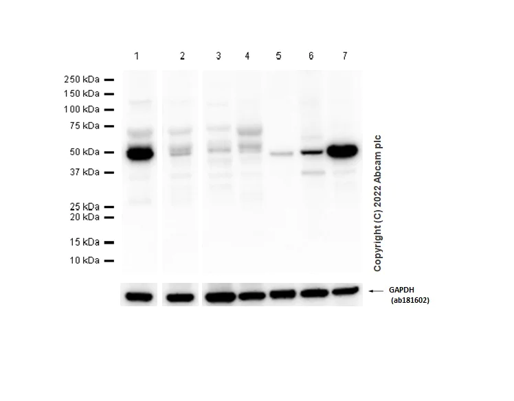 Western blot - Anti-C11B2/CYP11B2 antibody [EPR10495] - BSA and Azide free (AB240955)