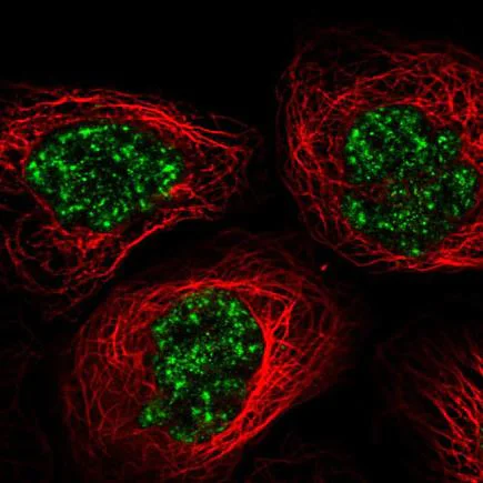 Immunocytochemistry/ Immunofluorescence - Anti-C11orf84 antibody (AB220962)