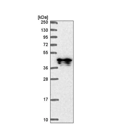 Western blot - Anti-C11orf84 antibody (AB220962)