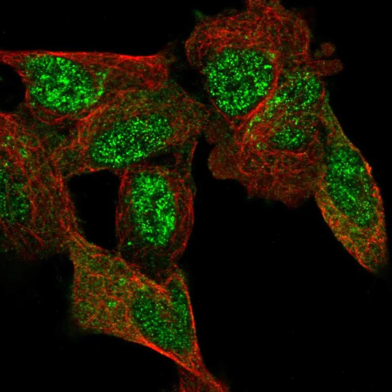 Immunocytochemistry - Anti-C11orf96 antibody (AB122512)