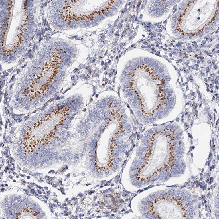 Immunohistochemistry (Formalin/PFA-fixed paraffin-embedded sections) - Anti-C11orf96 antibody (AB122512)