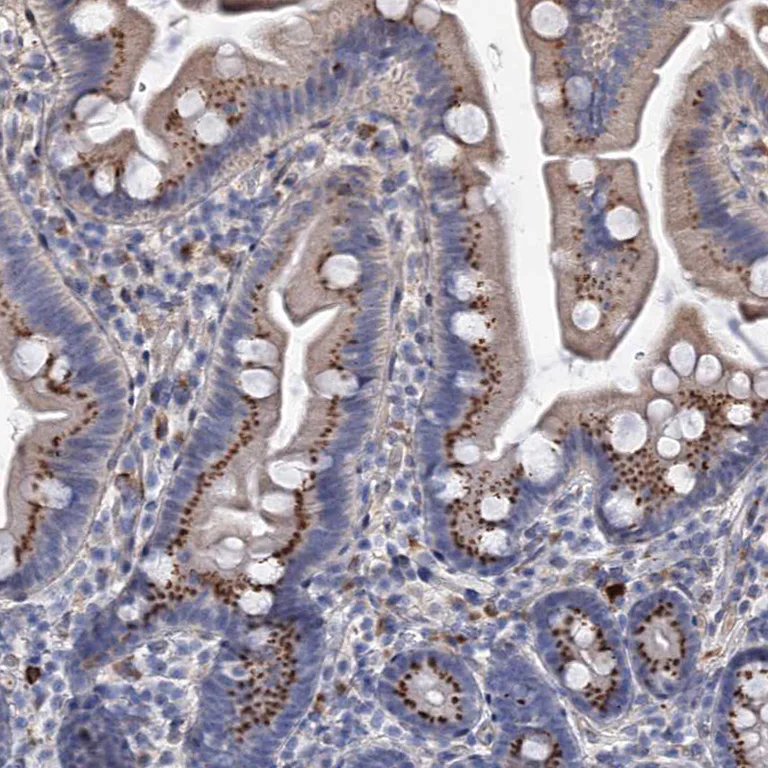 Immunohistochemistry (Formalin/PFA-fixed paraffin-embedded sections) - Anti-C11orf96 antibody (AB122512)