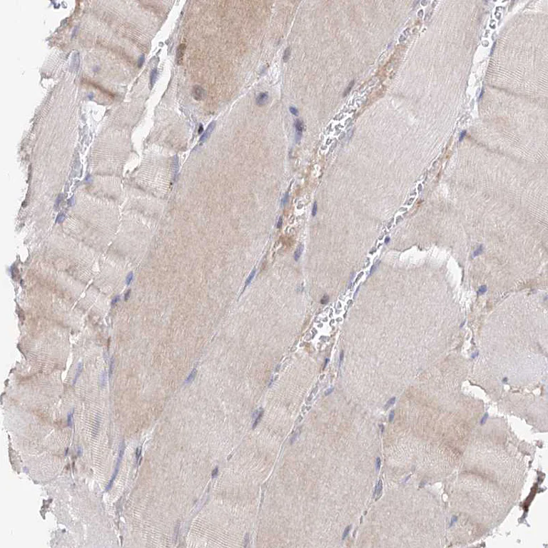 Immunohistochemistry (Formalin/PFA-fixed paraffin-embedded sections) - Anti-C11orf96 antibody (AB122512)