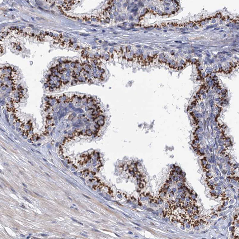 Immunohistochemistry (Formalin/PFA-fixed paraffin-embedded sections) - Anti-C11orf96 antibody (AB122512)