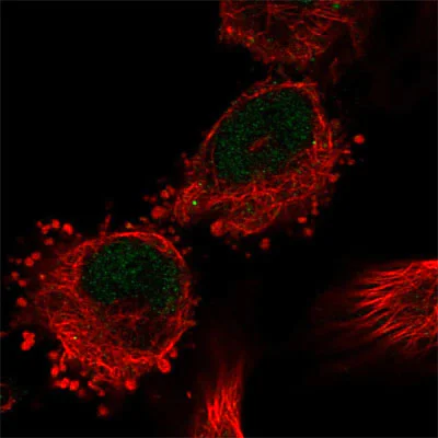 Immunocytochemistry/ Immunofluorescence - Anti-C12orf10 antibody (AB204420)