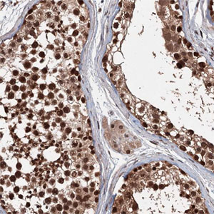Immunohistochemistry (Formalin/PFA-fixed paraffin-embedded sections) - Anti-C12orf10 antibody (AB204420)