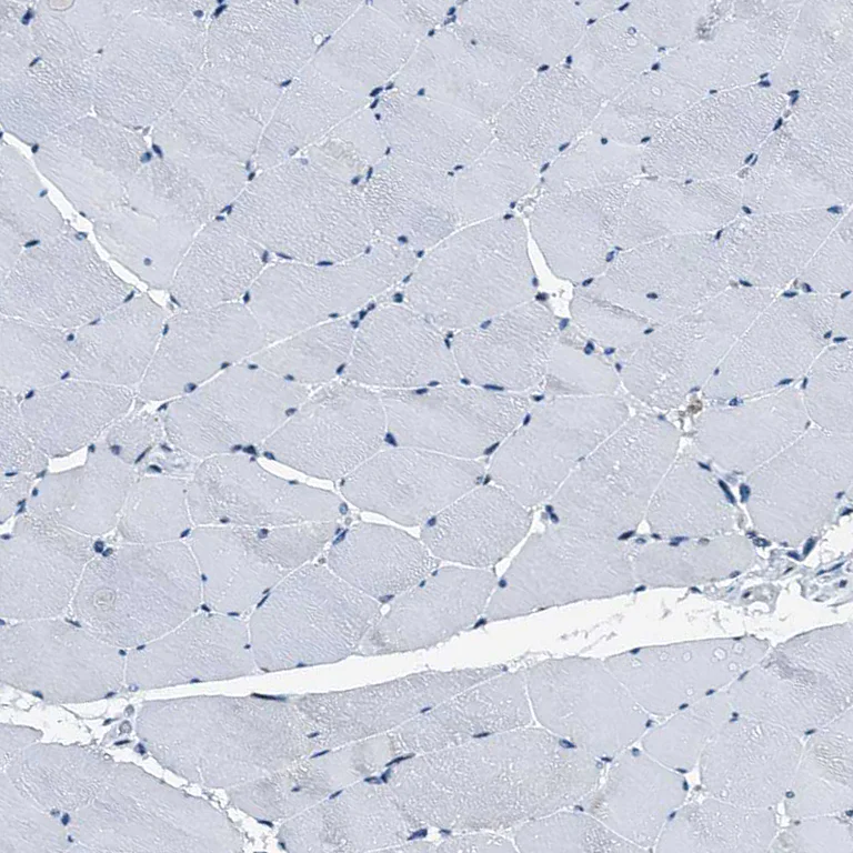 Immunohistochemistry (Formalin/PFA-fixed paraffin-embedded sections) - Anti-C12orf34 antibody (AB122626)