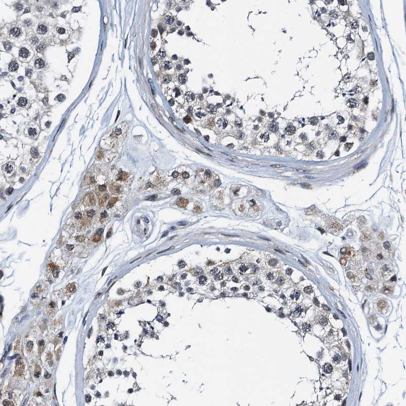 Immunohistochemistry (Formalin/PFA-fixed paraffin-embedded sections) - Anti-C12orf34 antibody (AB122626), expandable thumbnail