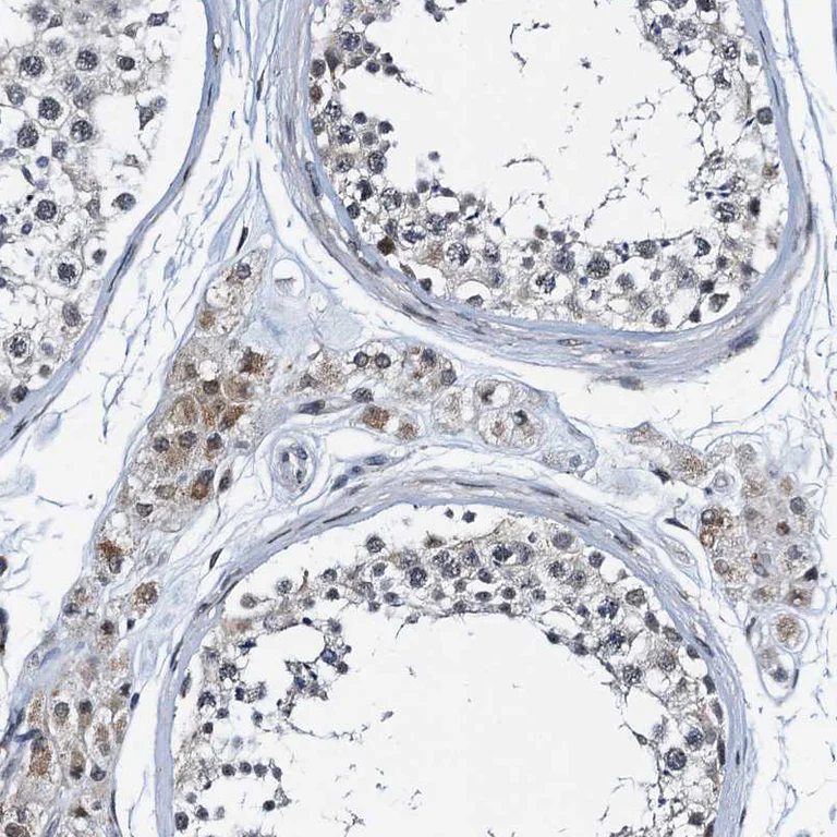 Immunohistochemistry (Formalin/PFA-fixed paraffin-embedded sections) - Anti-C12orf34 antibody (AB122626)
