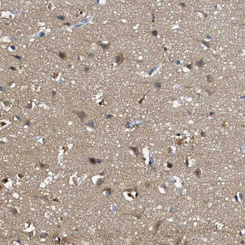Immunohistochemistry (Formalin/PFA-fixed paraffin-embedded sections) - Anti-C12orf34 antibody (AB122626), expandable thumbnail