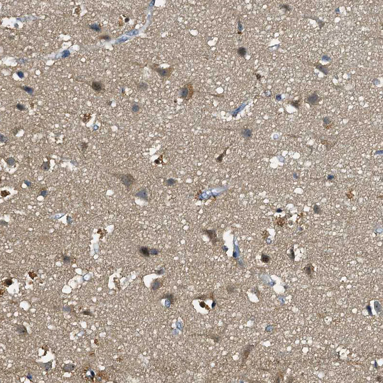 Immunohistochemistry (Formalin/PFA-fixed paraffin-embedded sections) - Anti-C12orf34 antibody (AB122626)