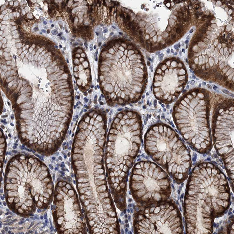 Immunohistochemistry (Formalin/PFA-fixed paraffin-embedded sections) - Anti-C12orf34 antibody (AB122626), expandable thumbnail