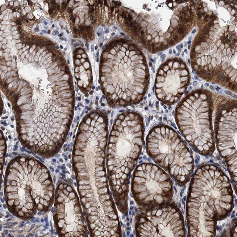 Immunohistochemistry (Formalin/PFA-fixed paraffin-embedded sections) - Anti-C12orf34 antibody (AB122626)