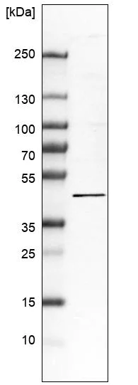 Western blot - Anti-C12orf34 antibody (AB122626)