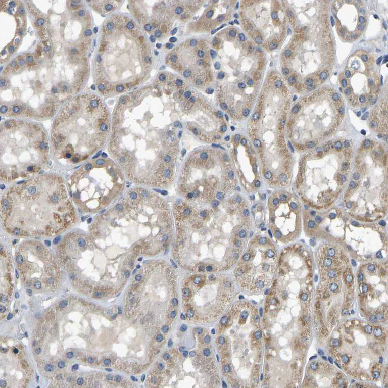 Immunohistochemistry (Formalin/PFA-fixed paraffin-embedded sections) - Anti-C12orf35 antibody (AB121408)