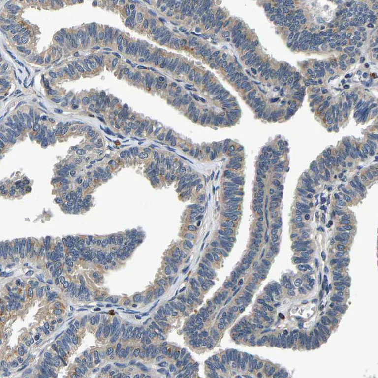 Immunohistochemistry (Formalin/PFA-fixed paraffin-embedded sections) - Anti-C12orf35 antibody (AB121408)