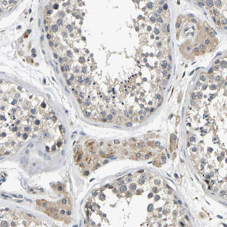 Immunohistochemistry (Formalin/PFA-fixed paraffin-embedded sections) - Anti-C12orf35 antibody (AB121408)