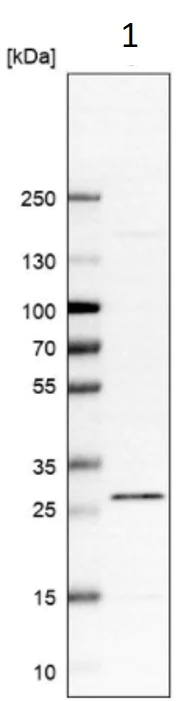 Western blot - Anti-C12orf65 antibody (AB122448)